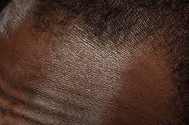 Why Your Skin Reacts When You Change Climates and How to Care for It Properly